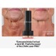 Lyma Laser Pro - Sale